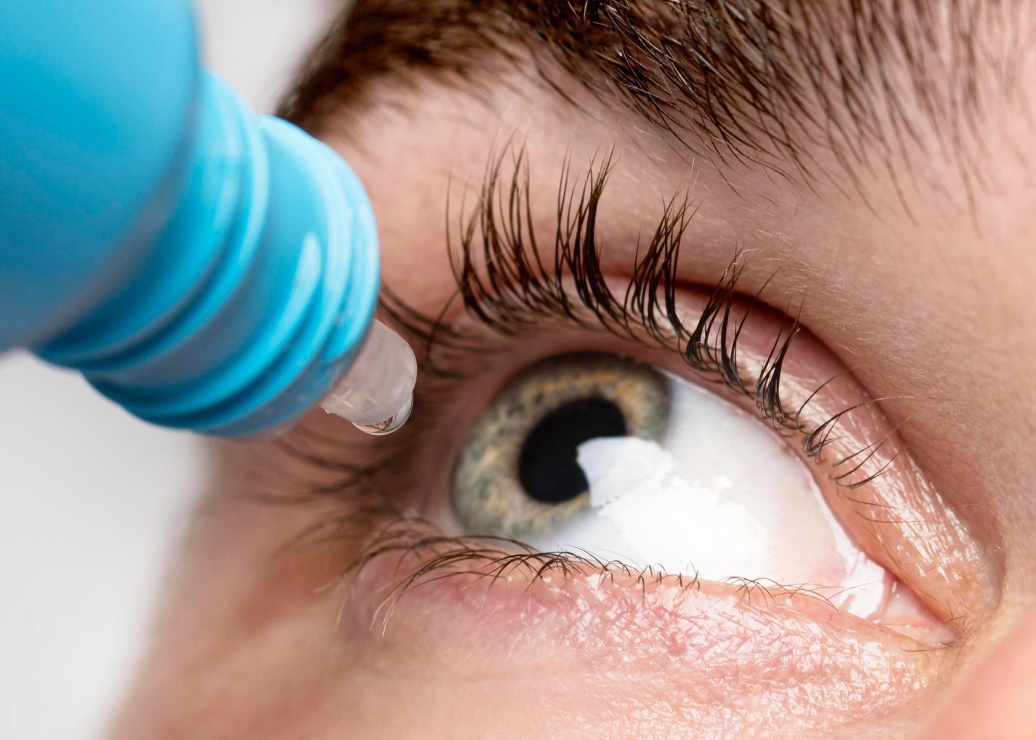Closeup of eye drops being applied Closeup of eye drops being applied